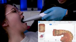 Medidenta - Videos - Aoralscan 3 (Wireless) Operating