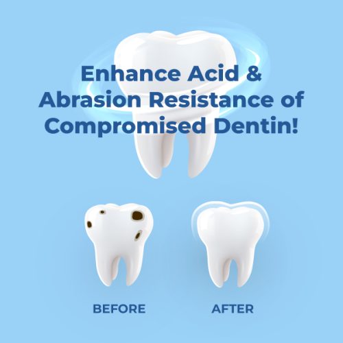 Medidenta - SDF Pro™ 38% Silver Diamine Fluoride Solution Unit Dose Kit - Gallery 04