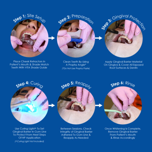 Whiter Image - Whitening - Gingival Barrier - 03