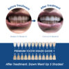 Whiter Image - Whitening - In-Office 40% HP 2 Patient Whitening Kit Syringe Refill - 06