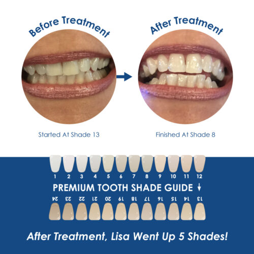 Whiter Image - Whitening - Nano-Bio Activation Toothpaste - 06