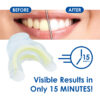 Whiter Image - Whitening - Prefilled Tray Kit - 03