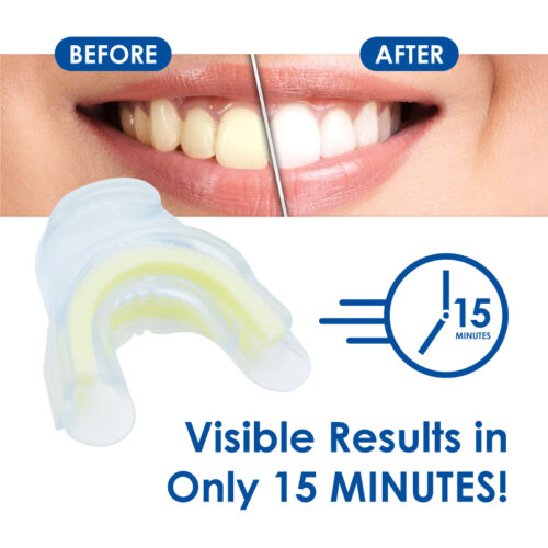 Whiter Image - Whitening - Prefilled Tray Kit - 03