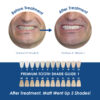 Whiter Image - Whitening - Prefilled Tray Kit - 07