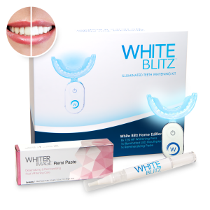 dental conduit - whitening - White Blitz Illuminating Teeth Whitening Kit