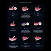 Medidenta - 3D Printing - Resins - Rodin® Soft Reline Kit - Gallery 03