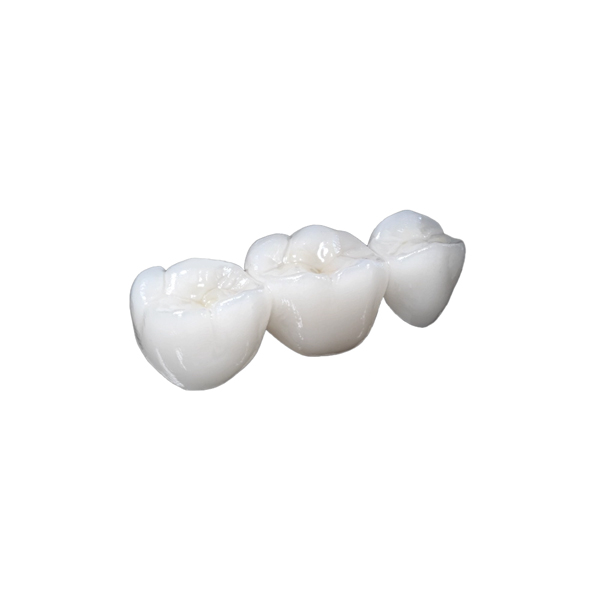 Medidenta - 3D Printing - Resins - Rodin® RapidCeram - Gallery 02