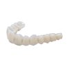 Medidenta - 3D Printing - Resins - Rodin® RapidCeram - Gallery 04