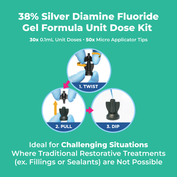 Medidenta - SDF Pro™ 38% Silver Diamine Fluoride Solution Unit Dose Kit - Gallery 01