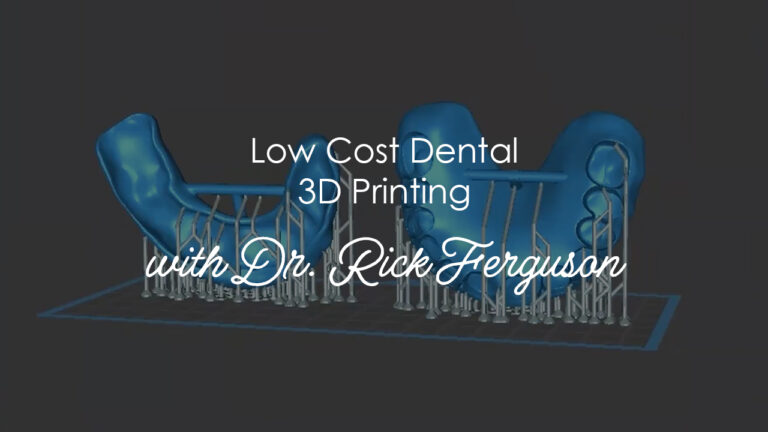 Medidenta - Videos - 3D Printing - How-Tos - Ferguson Accessories - Low Cost Dental 3D Printing - 01