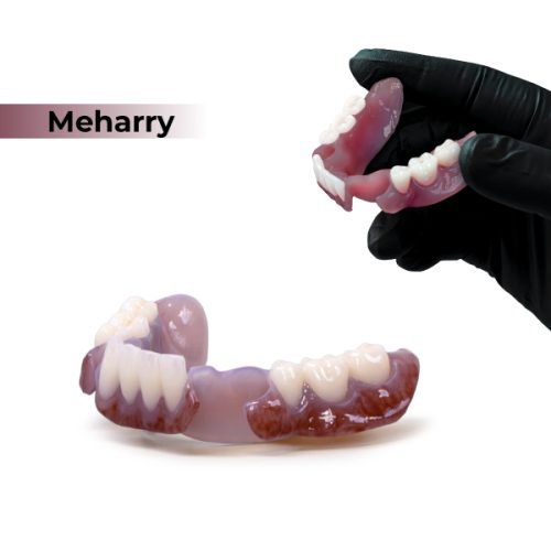 Medidenta - 3D Printing - Resins - Rodin® BioArch RPD 05 - Meharry
