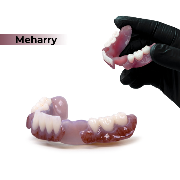 Medidenta - 3D Printing - Resins - Rodin® BioArch RPD 05 - Meharry
