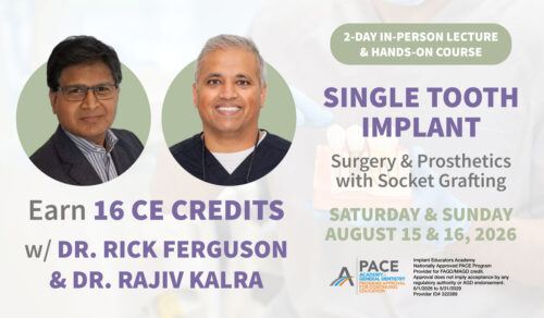 Medidenta - Blog - Single Tooth Implant Surgery: A Guide for Dentists