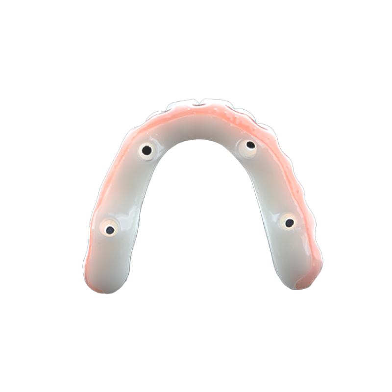 Full Arch Package
