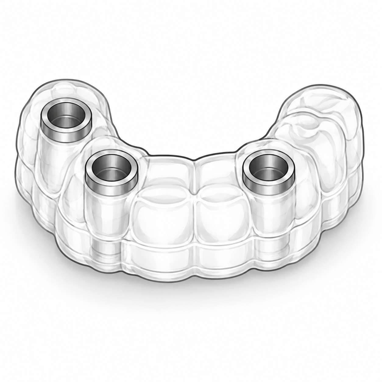 Surgical planning and stackable guide