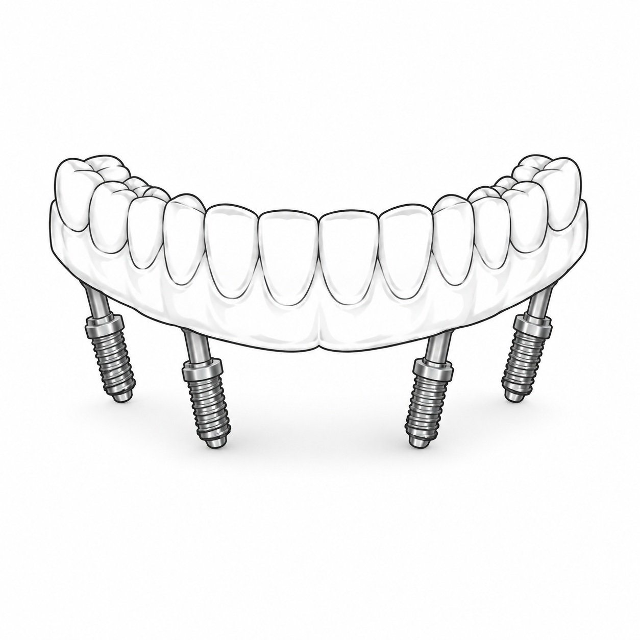 All-on-X FP1 design