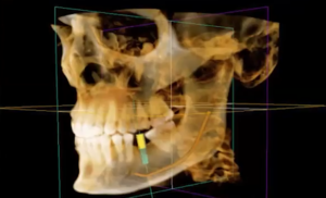 Medidenta - Webinars - Jorge Alegre - Paolo Lubrano - August 2026 - 02