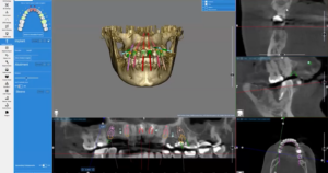 Medidenta - Webinars - Jorge Alegre - Paolo Lubrano - August 2026 - 03