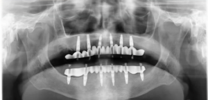 Medidenta - Webinars - Jorge Alegre - Paolo Lubrano - August 2026 - 05